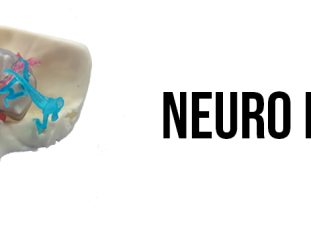 DA_2_NEURO MODEL 1