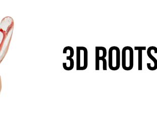 DA_4_3D ROOTS TOOTH 1
