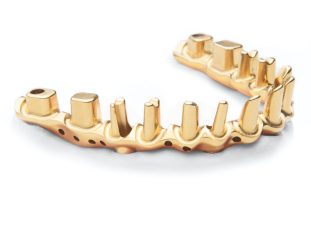 Hibrida-de-MunŢones-Abutment-Hybrid-Do-copia