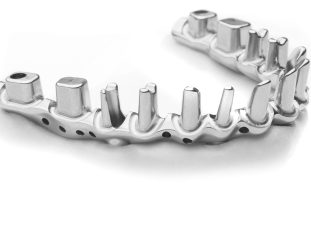 Hibrida-de-munones-Abutment-Hybrid-5