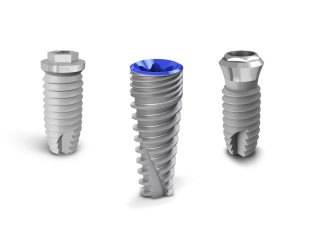 IMPLANTS