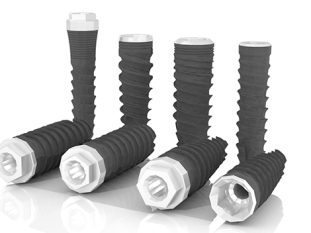 Implants